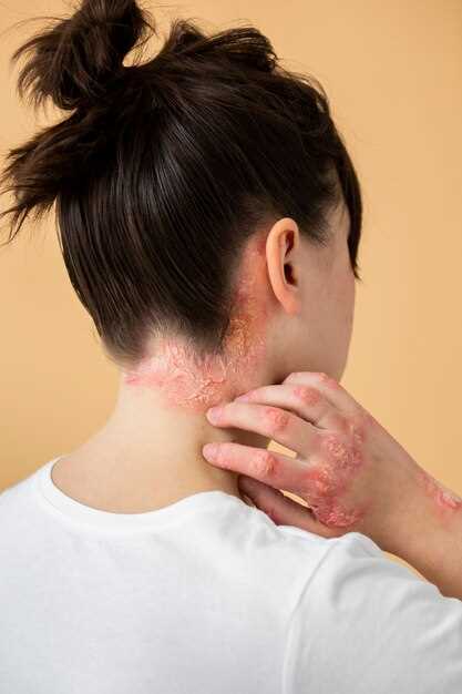 Аллергическая сыпь: причины, симптомы и лечение