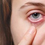 Ангиопатия сетчатки глаз: причины, симптомы, методы лечения