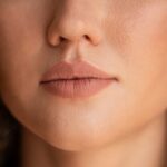 Белые угри на губах: причины, лечение и профилактика