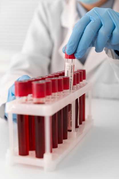 Роль липидного спектра крови в диагностике болезней