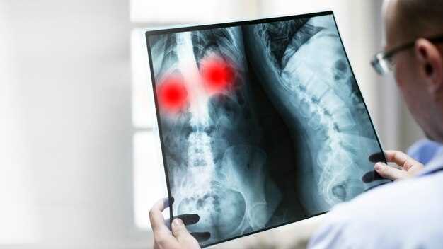 Принципы и цели исследования МРТ грудной клетки