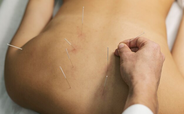 Физиотерапия в лечении кожных заболеваний: методы и результаты