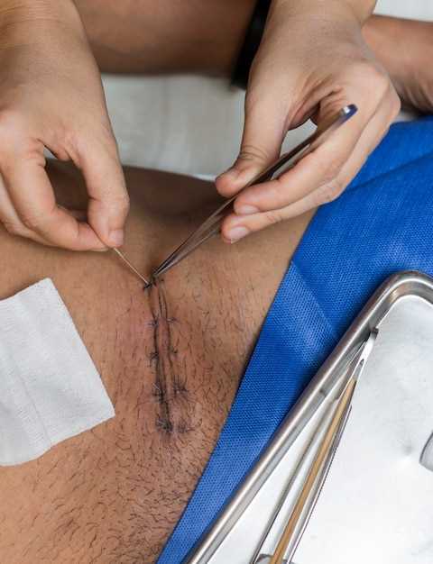 Процедура удаления швов после лапароскопии