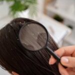 Какие гормоны проверить при выпадении волос у женщин необходимые анализы