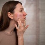 Красная сыпь на небе во рту: причины, симптомы, лечение