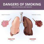 Легкие курильщика после отказа от курения: влияние на организм и способы восстановления