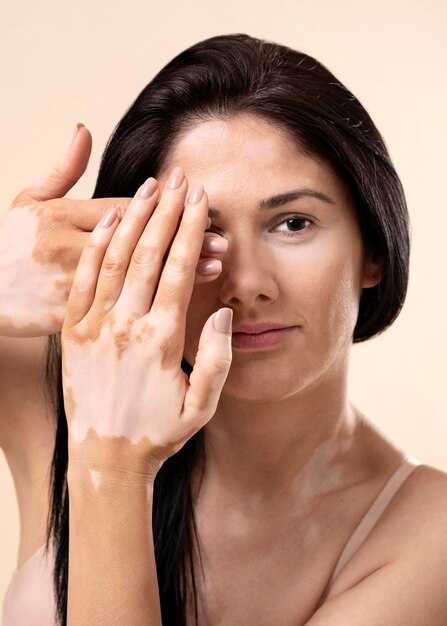 Нарушенный баланс микрофлоры кожи: причины, симптомы и способы восстановления