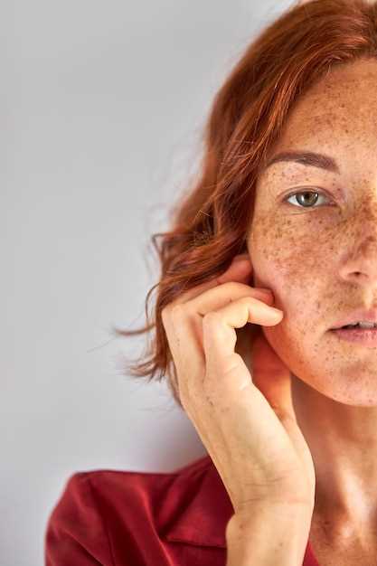 Лечение покраснений кожи: эффективные методы и средства