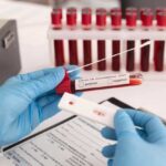 Повышенное содержание моноцитов в крови: расшифровка результатов, норма, причины патологии и мнения врачей