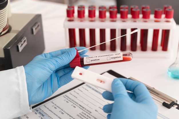 Исследование анализа крови и его значения