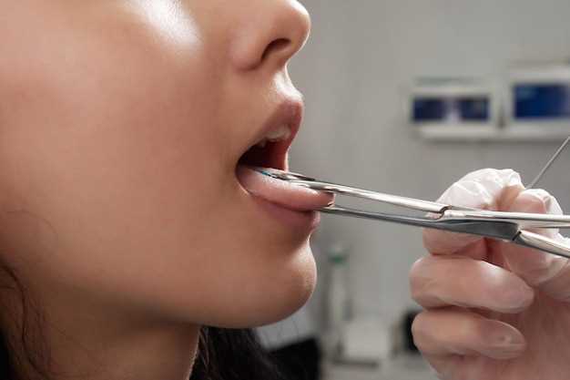 Почему появляется привкус металла во рту и как избавиться от него