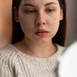 Себорейный дерматит на лице: причины, симптомы и методы лечения