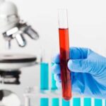 Серологические исследования крови: эффективная диагностика болезней