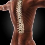 Стеноз спинномозгового канала: причины, симптомы, лечение
