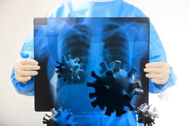 Туберкулез: симптомы, первые признаки, стадии лечения