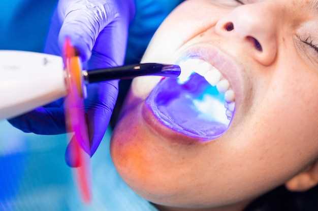 Удаление зубного налета: профессиональное чистка зубов