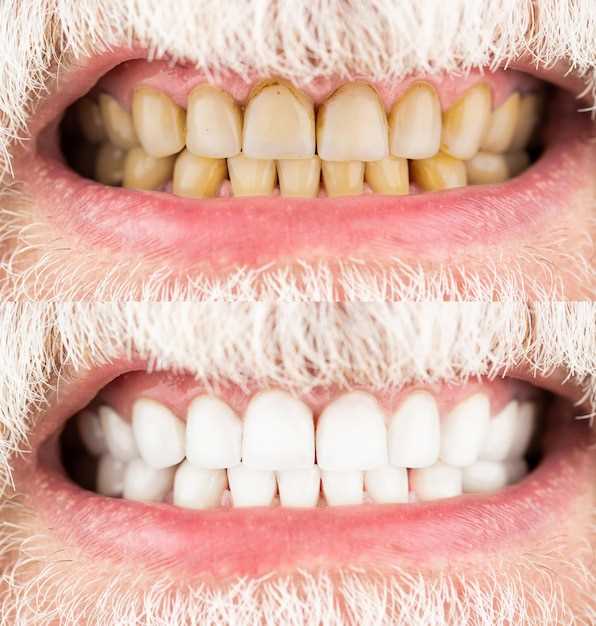 Адаптация и здоровые зубы